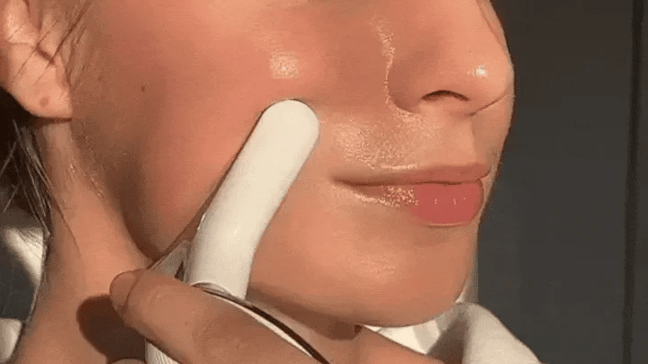 Masajeador Facial DermaLift Pro - Estimulante del rejuvenecimiento de las células de la piel.