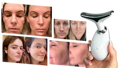 Masajeador Facial DermaLift Pro - Estimulante del rejuvenecimiento de las células de la piel. - Tienda SuaCalm