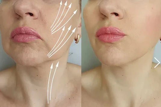 Masajeador Facial DermaLift Pro - Estimulante del rejuvenecimiento de las células de la piel. - Tienda SuaCalm